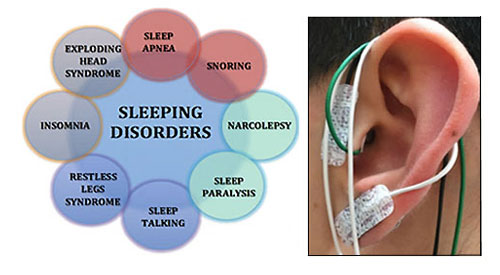 List of sleep disorders and ear with sensors